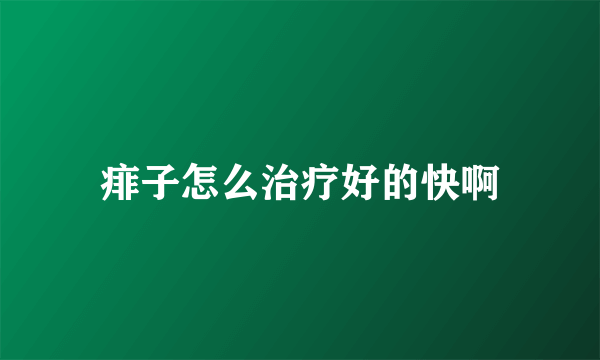 痱子怎么治疗好的快啊
