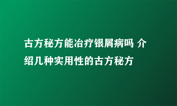 古方秘方能冶疗银屑病吗 介绍几种实用性的古方秘方