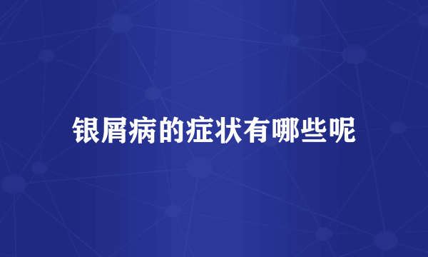 银屑病的症状有哪些呢