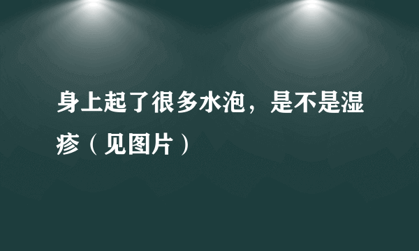 身上起了很多水泡，是不是湿疹（见图片）