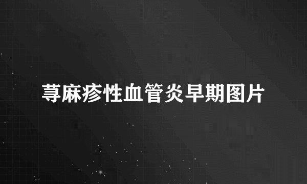 荨麻疹性血管炎早期图片