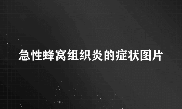 急性蜂窝组织炎的症状图片