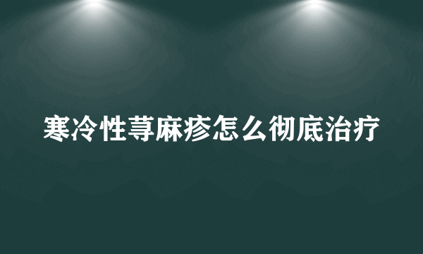 寒冷性荨麻疹怎么彻底治疗