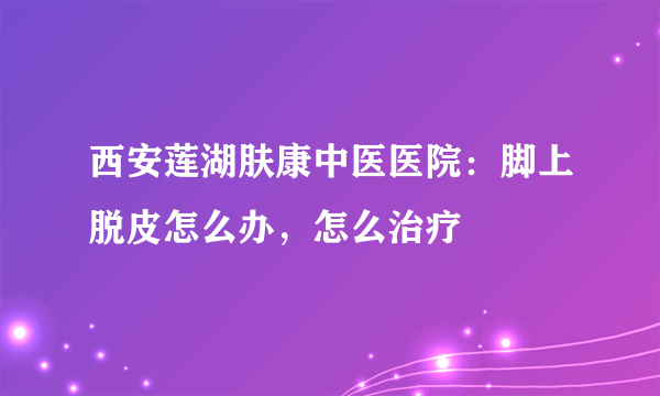西安莲湖肤康中医医院：脚上脱皮怎么办，怎么治疗