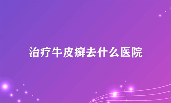 治疗牛皮癣去什么医院