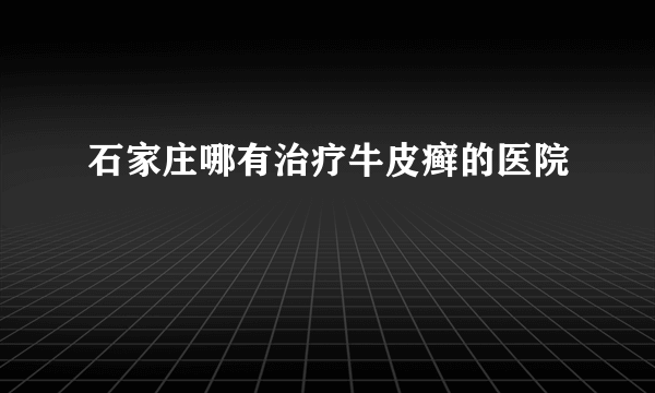 石家庄哪有治疗牛皮癣的医院