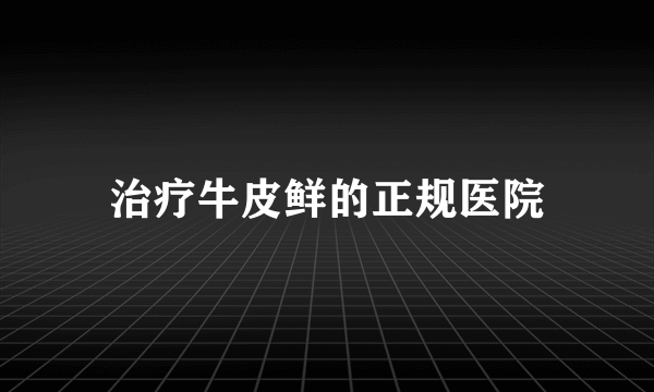 治疗牛皮鲜的正规医院