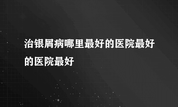 治银屑病哪里最好的医院最好的医院最好